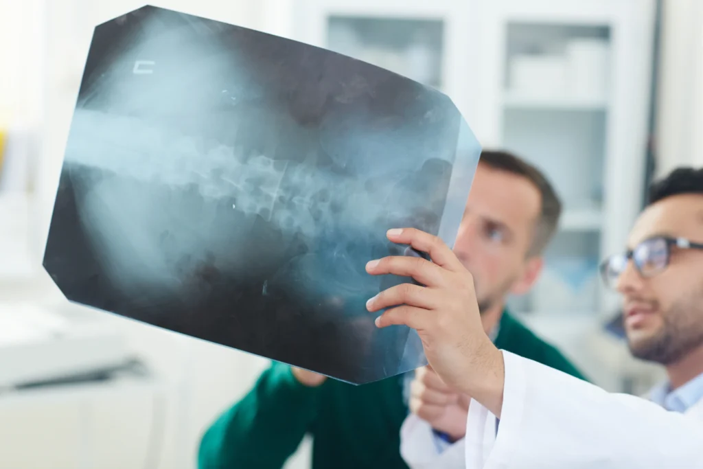 Doctors examining a spinal x-ray for a McCormick slip and fall injury victim.