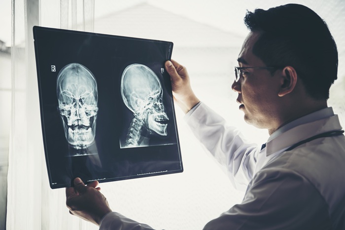 Doctor looks at xrays after a driver was hit by an uninsured motorist